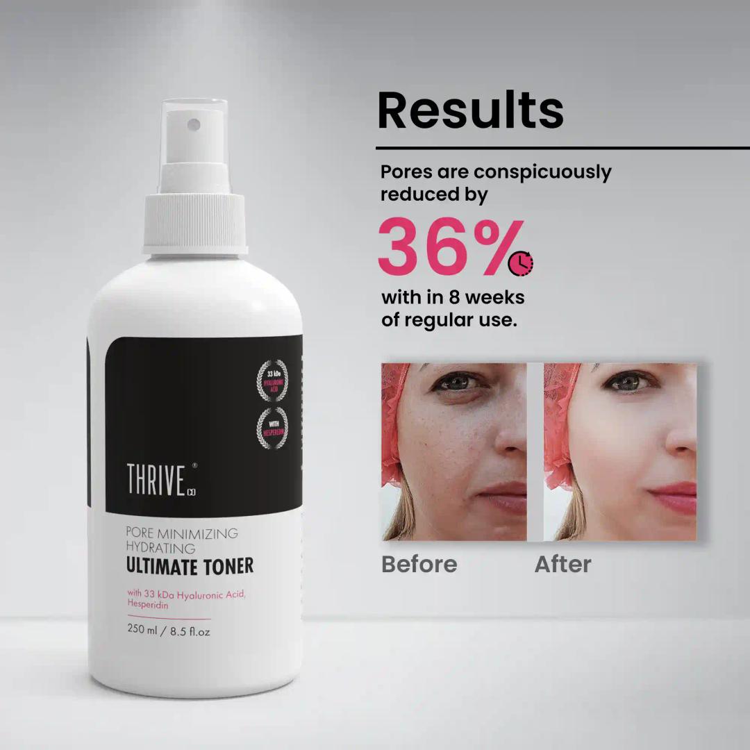 ThriveCo Pore-Minimizing Ultimate Toner, 250Ml