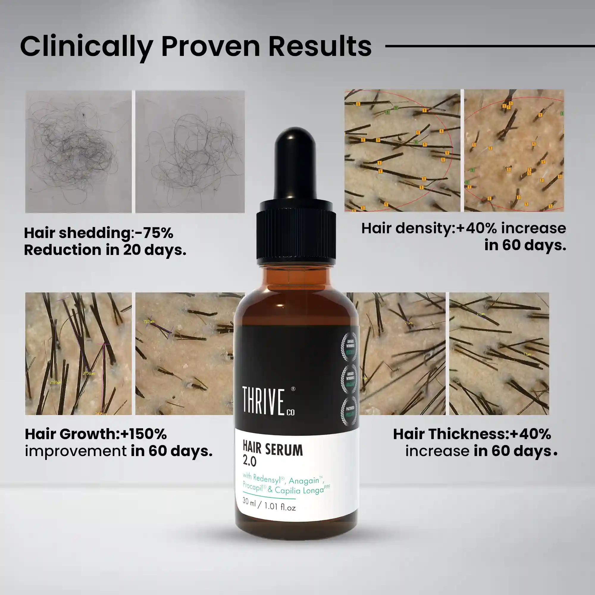 ThriveCo Restorative Hair Growth Kit: Hair Growth Serum 2.0 & Hair Vitalizing Rosemary Shampoo