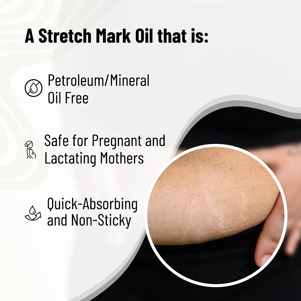 Chemist at Play Stretch Mark & Scar Fading Oil | Scar Removal & Reduce Stretch Marks | 10 Natural Oils (includes Almond, Rosemary, Rosehip Oils & more), Vitamin C & E | Pregnant Women Friendly | Mineral Oil Free | For Women & Men | 50ml